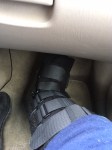 brokenankle2